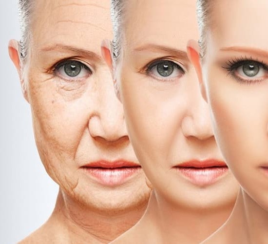 Anti-Aging IV 1 Anti-Aging IV 1